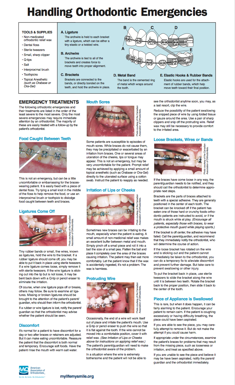 Handling Orthodontic Emergencies